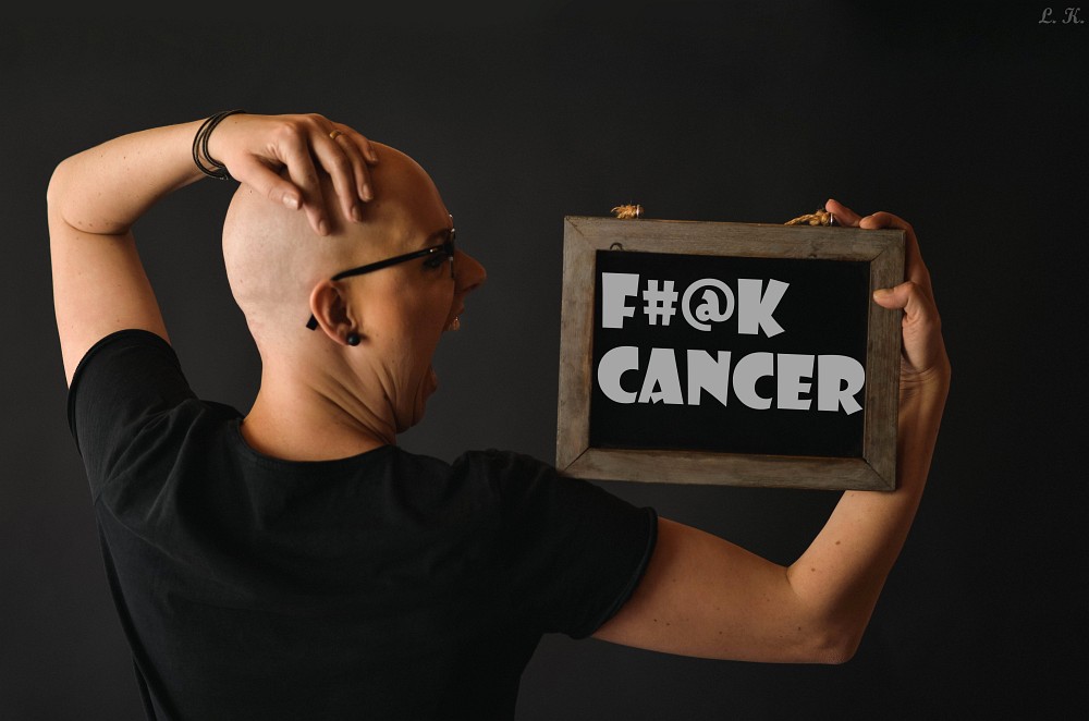 Kahlrasierte Frau hält Schild mit f#@ck Cancer hoch